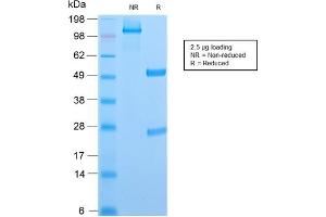 SDS-PAGE Analysis Purified CD6 Rabbit Recombinant Monoclonal Antibody (C6/2884R). (Recombinant CD6 antibody)
