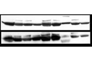 Image no. 5 for anti-Nuclear Factor-kB p65 (NFkBP65) (pSer276) antibody (ABIN1103942) (NF-kB p65 antibody  (pSer276))