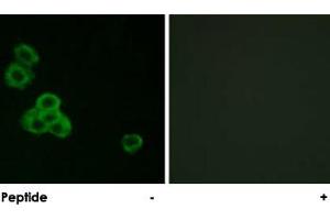 Immunofluorescence analysis of MCF-7 cells, using CAMK2A/CAMK2D polyclonal antibody .