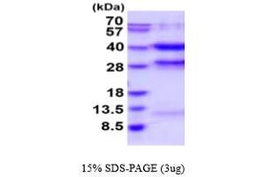 SDS-PAGE (SDS) image for Protein Phosphatase 1, Catalytic Subunit, gamma Isoform (PPP1CC) (AA 1-323) (Active) protein (His tag) (ABIN7281231)