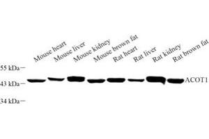 Western blot analysis of ACOT1 (ABIN7072932) at dilution of 1: 3000 (ACOT1 antibody)
