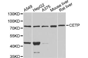 Western blot analysis of extracts of various cell lines, using CETP antibody. (CETP antibody)