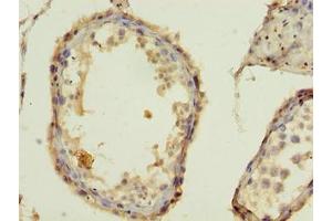 Immunohistochemistry of paraffin-embedded human testis tissue using ABIN7155653 at dilution of 1:100 (BARX1 antibody  (AA 1-100))