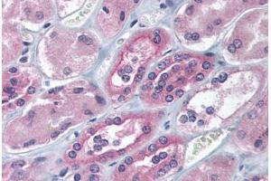 Human Kidney (formalin-fixed, paraffin-embedded) stained with IGF2BP1 antibody ABIN214118 at 5 ug/ml followed by biotinylated goat anti-rabbit IgG secondary antibody ABIN481713, alkaline phosphatase-streptavidin and chromogen. (IGF2BP1 antibody  (AA 155-204))
