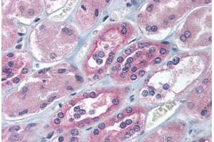 Human Kidney (formalin-fixed, paraffin-embedded) stained with IGF2BP1 antibody ABIN214118 at 5 ug/ml followed by biotinylated goat anti-rabbit IgG secondary antibody ABIN481713, alkaline phosphatase-streptavidin and chromogen.