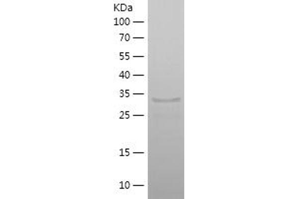 Scinderin Protein (SCIN) (AA 600-715) (His-IF2DI Tag)