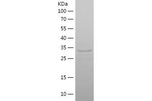 Western Blotting (WB) image for Scinderin (SCIN) (AA 600-715) protein (His-IF2DI Tag) (ABIN7282721) (Scinderin Protein (SCIN) (AA 600-715) (His-IF2DI Tag))