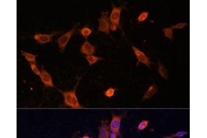 Immunofluorescence analysis of NIH-3T3 cells using UFC1 Polyclonal Antibody at dilution of 1:100 (40x lens). (UFC1 antibody)
