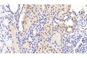 Immunohistochemistry (IHC) image for anti-BCL2-Like 11 (Apoptosis Facilitator) (BCL2L11) (AA 2-120) antibody (ABIN7430234)