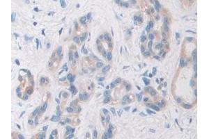 Immunohistochemistry (IHC) image for anti-phosphorylase, Glycogen, Brain (GPBB) (AA 477-731) antibody (ABIN7439942)