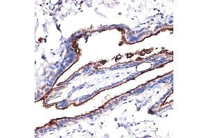 Immunohistochemistry (IHC) image for anti-Mucin 1 (MUC1) (AA 1182-1255) antibody (ABIN6144194)
