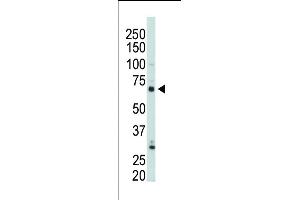 PIP5K1C antibody  (N-Term)