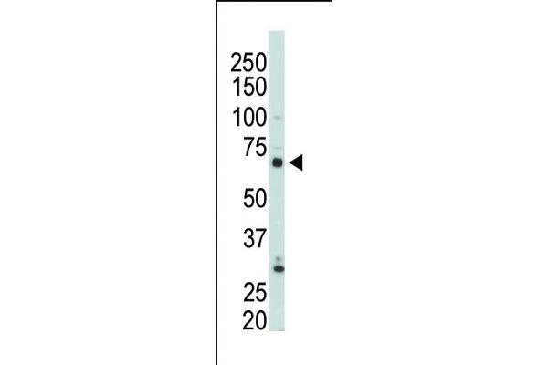 PIP5K1C antibody  (N-Term)