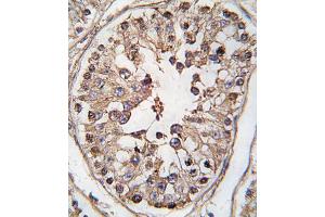 Formalin-fixed and paraffin-embedded human testis tissue reacted with TBK-p, which was peroxidase-conjugated to the secondary antibody, followed by DAB staining. (TBK1 antibody  (AA 150-181))