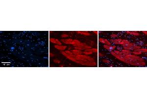 Rabbit Anti-ENO3 Antibody    Formalin Fixed Paraffin Embedded Tissue: Human Adult heart  Observed Staining: Cytoplasmic Primary Antibody Concentration: 1:100 Secondary Antibody: Donkey anti-Rabbit-Cy2/3 Secondary Antibody Concentration: 1:200 Magnification: 20X Exposure Time: 0. (ENO3 antibody  (N-Term))
