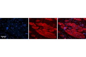 Rabbit Anti-ENO3 Antibody    Formalin Fixed Paraffin Embedded Tissue: Human Adult heart  Observed Staining: Cytoplasmic Primary Antibody Concentration: 1:100 Secondary Antibody: Donkey anti-Rabbit-Cy2/3 Secondary Antibody Concentration: 1:200 Magnification: 20X Exposure Time: 0.