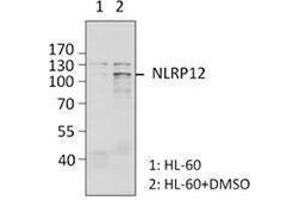 Western Blotting (WB) image for anti-NLR Family, Pyrin Domain Containing 12 (NLRP12) antibody (ABIN2665297) (NLRP12 antibody)