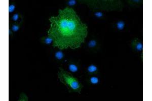 Anti-MAPRE2 mouse monoclonal antibody (ABIN2454619) immunofluorescent staining of COS7 cells transiently transfected by pCMV6-ENTRY MAPRE2 (RC200259). (MAPRE2 antibody)