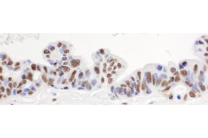 anti-Heterogeneous Nuclear Ribonucleoprotein H1 (H) (HNRNPH1) (C-Term) antibody