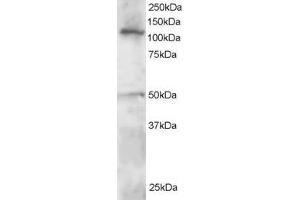 Western Blotting (WB) image for anti-Helicase-Like Transcription Factor (HLTF) (C-Term) antibody (ABIN2466282) (HLTF antibody  (C-Term))