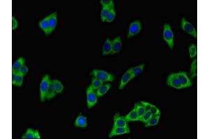 Immunofluorescent analysis of HepG2 cells using ABIN7163370 at dilution of 1:100 and Alexa Fluor 488-congugated AffiniPure Goat Anti-Rabbit IgG(H+L) (ATP8A2 antibody  (AA 358-570))