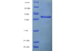 SDS-PAGE (SDS) image for Carnitine Palmitoyltransferase 1C (CPT1C) (AA 114-333), (partial) protein (His-SUMO Tag) (ABIN5709369)
