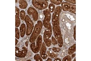 Immunohistochemical staining of human kidney with EXOC3L1 polyclonal antibody  shows strong cytoplasmic positivity in cells in tubules at 1:200-1:500 dilution.