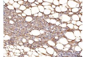 IHC analysis of NDUFB8 using anti-NDUFB8 antibody (ABIN7599048).