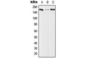 Western blot analysis of EGFR (pT678) expression in A431 EGF-treated (A), NIH3T3 EGF-treated (B), PC12 EGF-treated (C) whole cell lysates. (EGFR antibody  (pSer678))