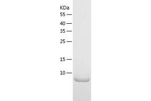 CMC4 Protein (AA 1-68) (His tag)