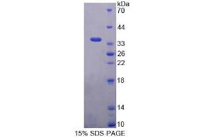 SDS-PAGE (SDS) image for BCL2-Associated Athanogene 4 (BAG4) (AA 210-447) protein (His tag) (ABIN4990374)