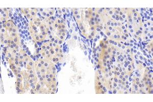 Detection of BMP6 in Human Kidney Tissue using Polyclonal Antibody to Bone Morphogenetic Protein 6 (BMP6) (BMP6 antibody  (AA 375-513))