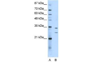 BXDC5 antibody used at 0. (RPF1 antibody  (N-Term))