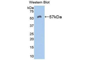Western Blotting (WB) image for anti-Aldehyde Dehydrogenase 7 Family, Member A1 (ALDH7A1) (AA 29-539) antibody (ABIN1077760) (ALDH7A1 antibody  (AA 29-539))