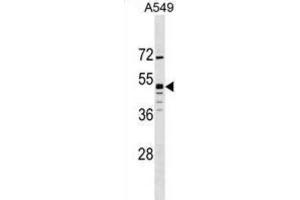 Western Blotting (WB) image for anti-G Protein-Coupled Receptor 83 (GPR83) antibody (ABIN3000043)