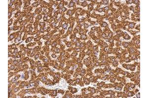 IHC-P Image ABAT antibody detects ABAT protein at mitochondria on mouse liver by immunohistochemical analysis. (ABAT antibody)