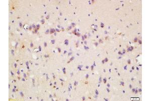 Formalin-fixed and paraffin embedded rat brain labeled with Rabbit Anti-Wnt8b Polyclonal Antibody, Unconjugated  at 1:200 followed by conjugation to the secondary antibody and DAB staining (WNT8B antibody  (AA 131-230))
