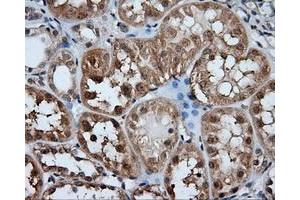 Immunohistochemical staining of paraffin-embedded liver tissue using anti-HDAC10 mouse monoclonal antibody. (HDAC10 antibody)