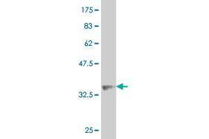 Western Blot detection against Immunogen (37. (ALPK2 antibody  (AA 201-309))