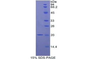 SDS-PAGE analysis of Rat Interleukin 17B Protein.
