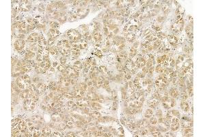 anti-Adenylate Cyclase 3 (ADCY3) (C-Term) antibody