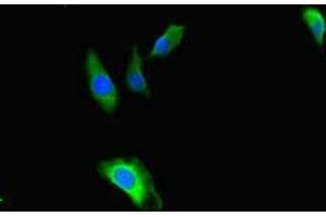 Immunofluorescent analysis of Hela cells using ABIN7171622 at dilution of 1:100 and Alexa Fluor 488-congugated AffiniPure Goat Anti-Rabbit IgG(H+L) (TBC1D24 antibody  (AA 1-169))