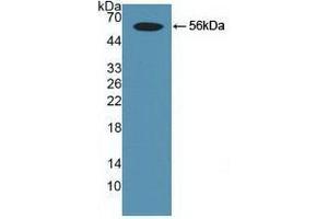 Detection of Recombinant Smad9, Human using Polyclonal Antibody to SMAD family member 9 (SMAD9) (SMAD9 antibody  (AA 226-459))