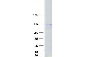 Western Blotting (WB) image for Prolyl 4-Hydroxylase, alpha Polypeptide I (P4HA1) (Transcript Variant 2) protein (Myc-DYKDDDDK Tag) (ABIN2728090)