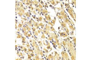 Immunohistochemistry (IHC) image for anti-Caspase 3 (CASP3) (AA 55-160) antibody (ABIN6219373) (Caspase 3 antibody  (AA 55-160))