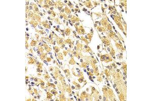 Immunohistochemistry (IHC) image for anti-Caspase 3 (CASP3) (AA 55-160) antibody (ABIN6219373)