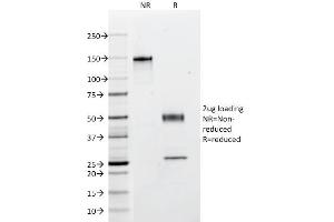 SDS-PAGE Analysis Purified Multi Cytokeratin Mouse Monoclonal Antibody (C11). (KRT4, KRT5, KRT6, KRT8, KRT10, KRT13, KRT18 antibody)