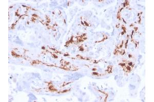 Formalin-fixed, paraffin-embedded human placenta stained with Factor 13A Recombinant Rabbit Monoclonal Antibody (F13A1/3772R). (Recombinant F13A1 antibody  (AA 46-181))