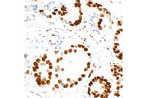 Immunohistochemistry (IHC) image for anti-Fused in Sarcoma (FUS) (AA 1-50) antibody (ABIN7454040) (Recombinant FUS antibody  (AA 1-50))
