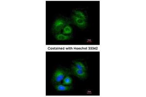 ICC/IF Image Immunofluorescence analysis of methanol-fixed A549, using SIRT3, antibody at 1:200 dilution. (SIRT3 antibody  (C-Term))